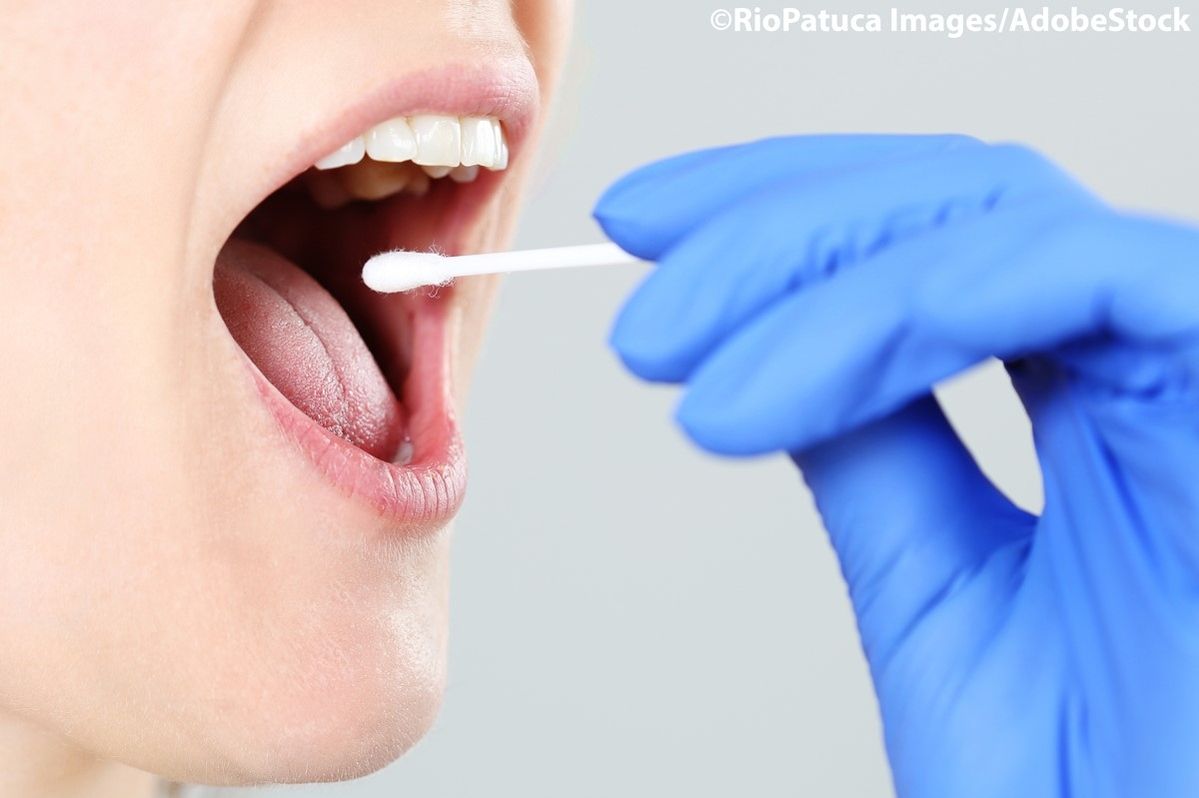 Eine Person macht einen Mundabstrich zur Diagnostik.